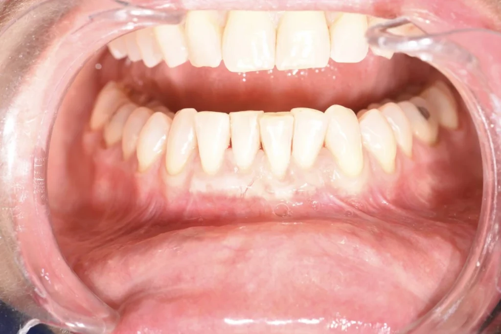 soin gencives paris 2