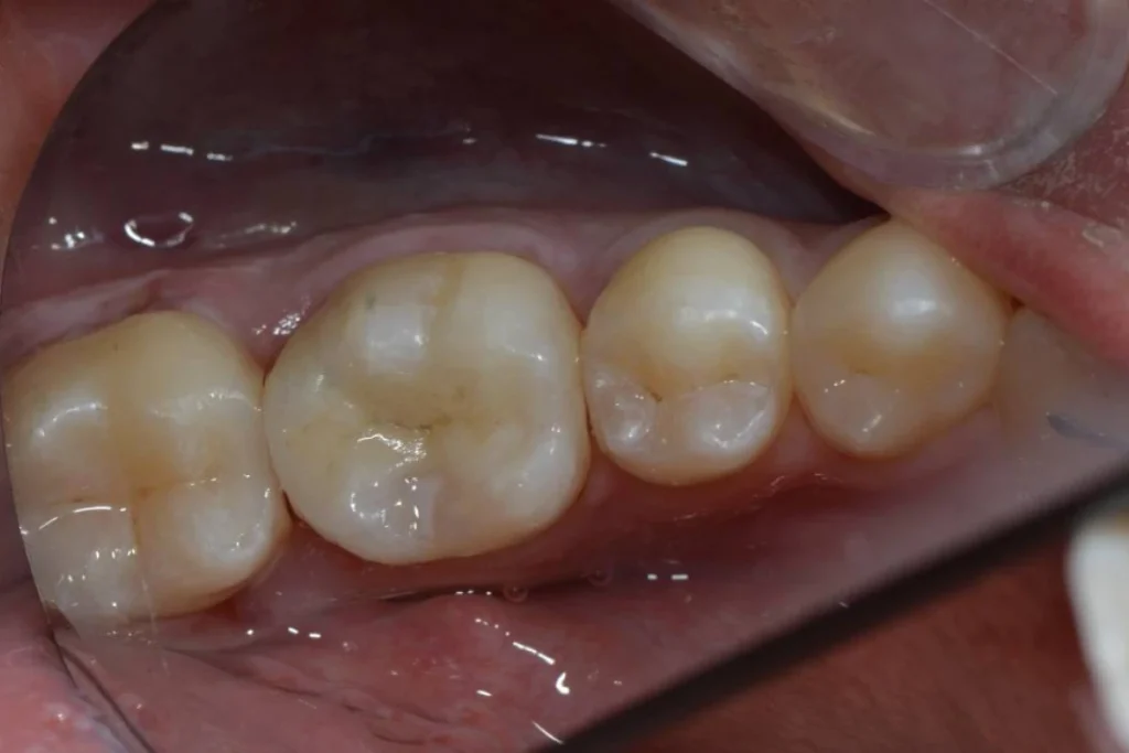 soins conservateurs paris