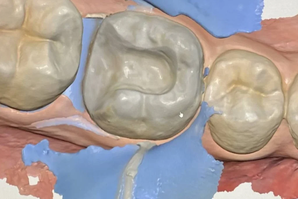 soins conservateurs paris 11