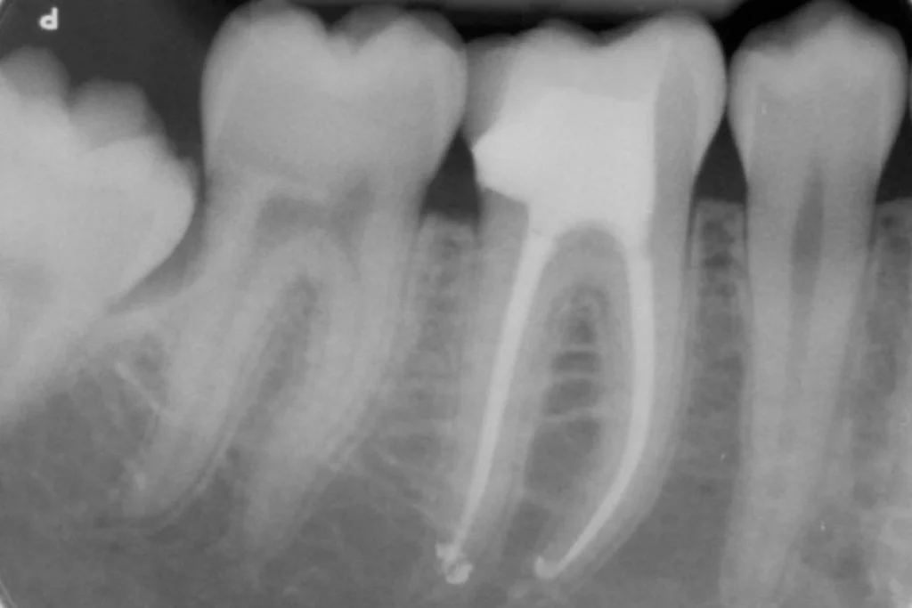 soins conservateurs paris 17