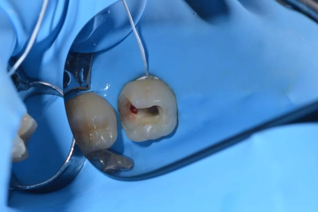 soins conservateurs paris 3